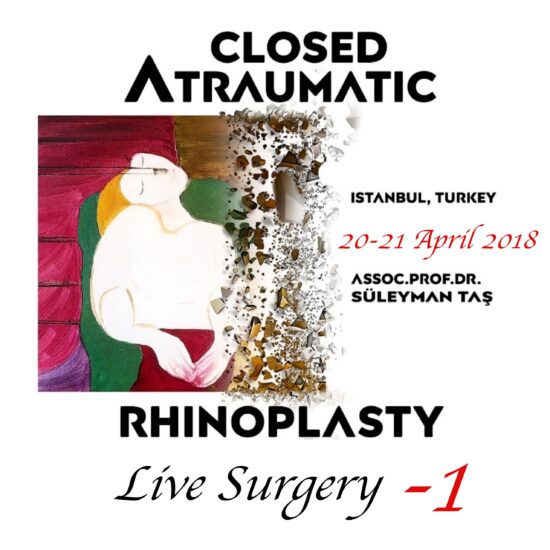 Closed atraumatic rhinoplasty live surgery dvd 1 / digital