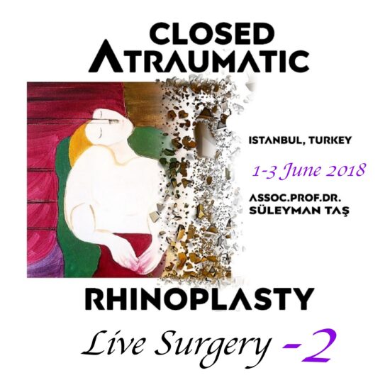 Closed atraumatic rhinoplasty live surgery dvd 2 / digital