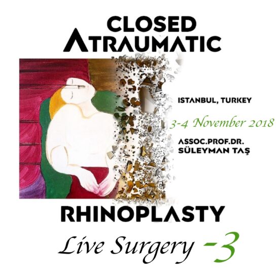 Closed atraumatic rhinoplasty live surgery dvd 3 / digital