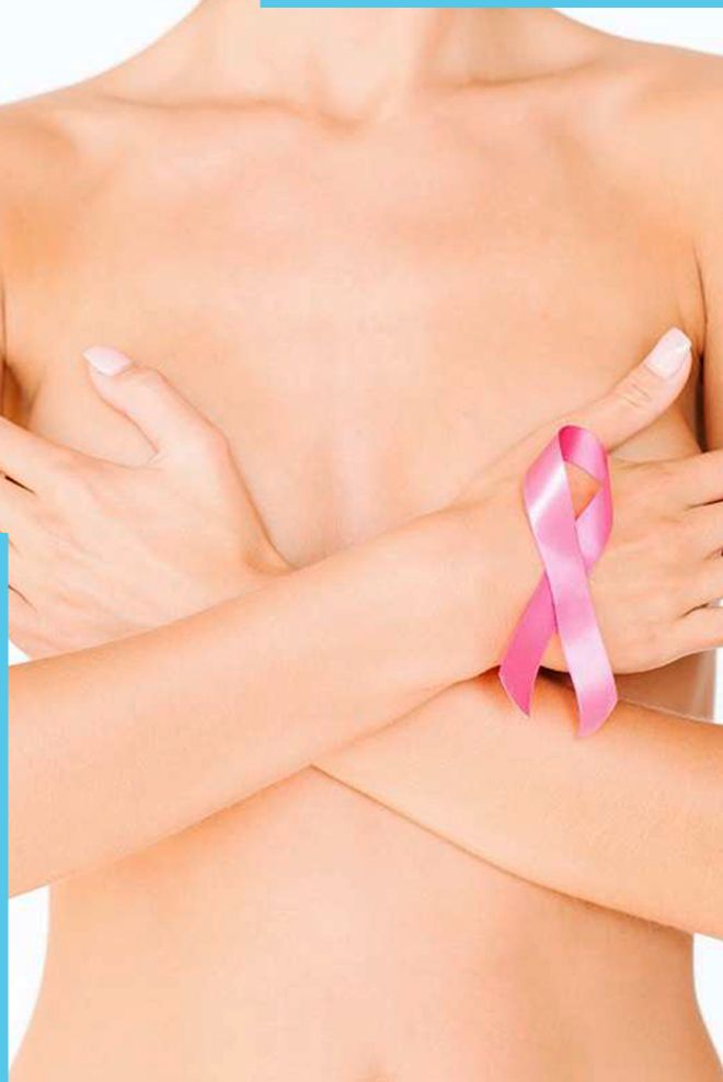 Breast reconstruction after breast cancer