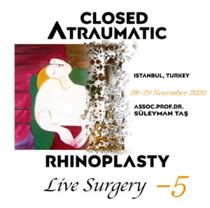 Closed Atraumatic Rhinoplasty Live Surgery DVD 5 / Digital