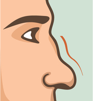 How should a natural nose be?