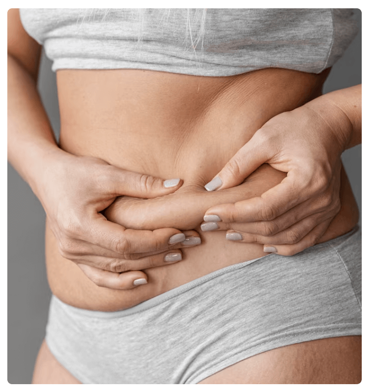 What is a tummy tuck surgery how is it performed