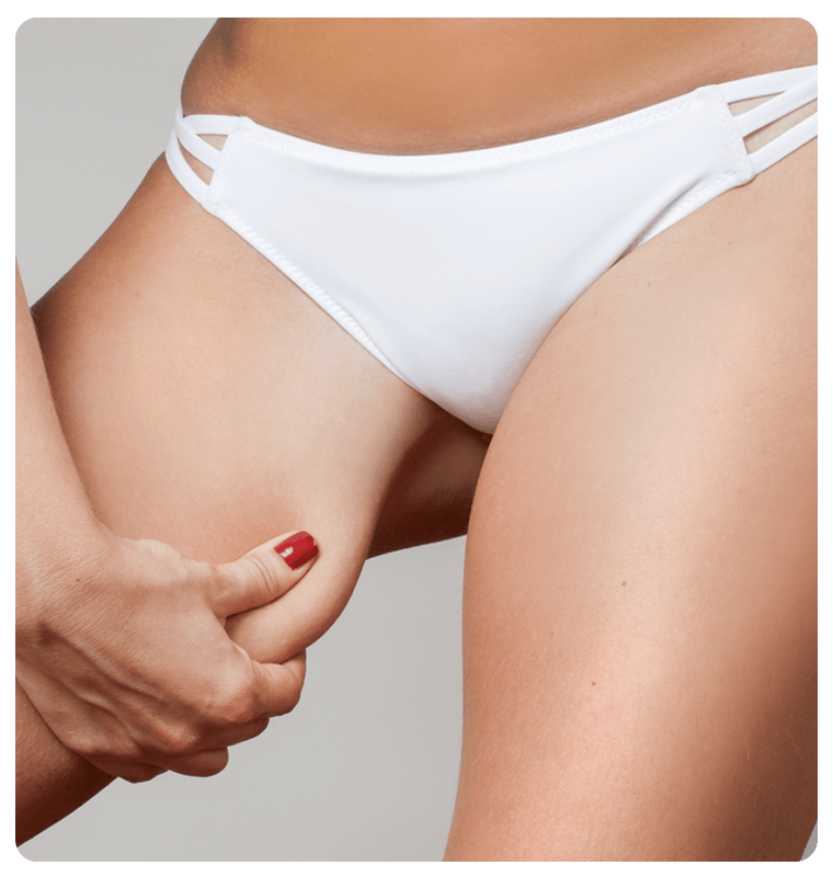 Faq about thigh lift in istanbul