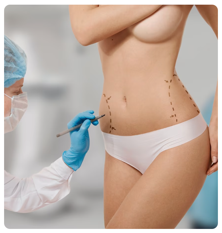 Faq about liposuction in istanbul