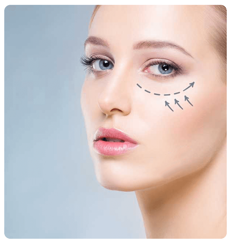 Before eyelid surgery considerations