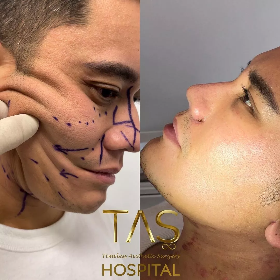 Case study number 4 - aesthetic facial treatments
