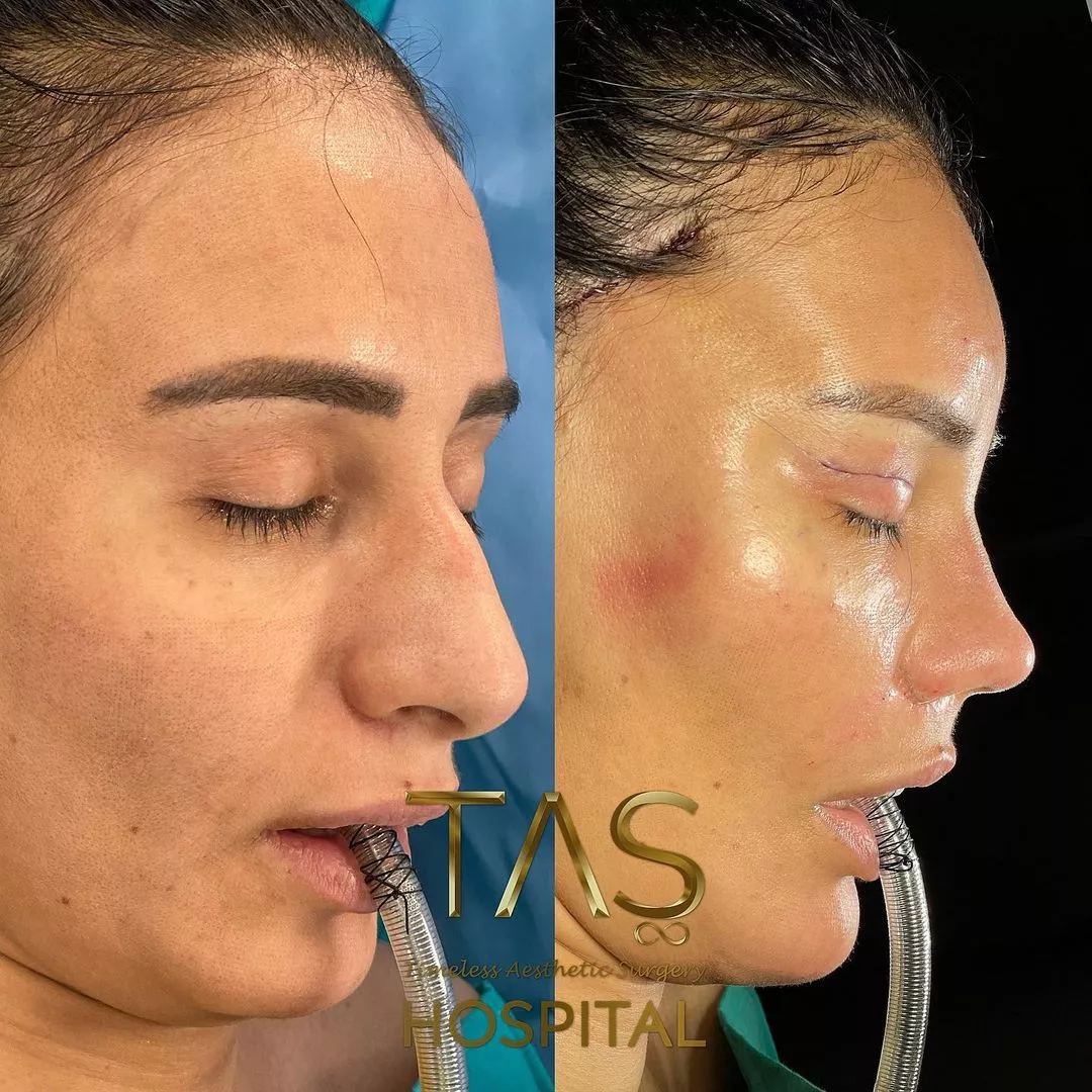 Case study number 9 - youthful facial appearance