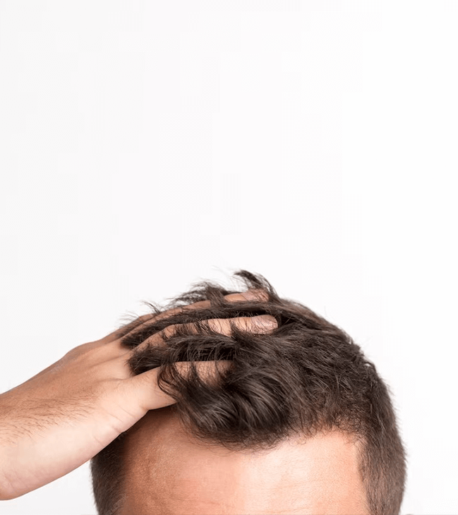 What-are-the-best-hair-transplant-techniques
